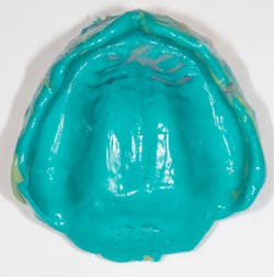 Aquasil Ultra+ light viscosity fast set to wash Aquasil Ultra+ light viscosity fast set to wash