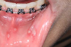 Fig2 Img 3569 Fig2 Img 3569