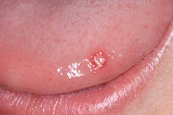 Fig3 Img 3570 Fig3 Img 3570