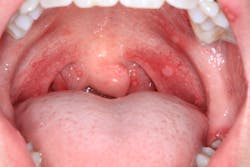 Fig4 Img 3571 Fig4 Img 3571