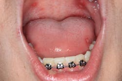 Fig5 Img 3572 Fig5 Img 3572