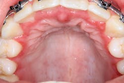 Fig6 Img 3573 Fig6 Img 3573