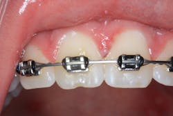 Fig7 Img 3574 Fig7 Img 3574