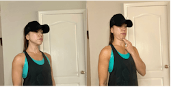 Figure 3: Chin tucks Figure 3: Chin tucks