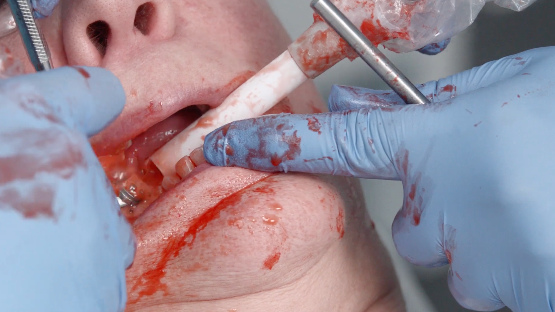 Microsoft Teams Image 54 63d02cf421d3b