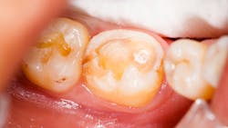 Dreamstime M 34464563 63b44caa3876f Dreamstime M 34464563 63b44caa3876f