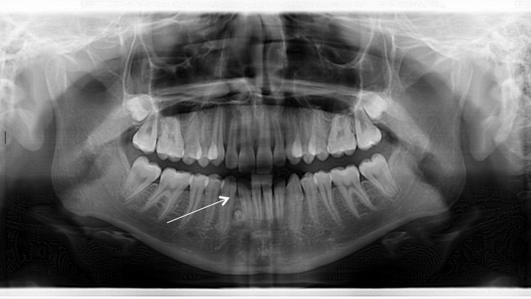 Screen Shot 2015 02 17 At 12 39 21 Pm 63ee868bc5aa3