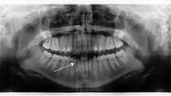 Screen Shot 2015 02 17 At 12 39 21 Pm 63ee868bc5aa3 Screen Shot 2015 02 17 At 12 39 21 Pm 63ee868bc5aa3