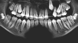 Pan Patient2 63ee6519b40fa Pan Patient2 63ee6519b40fa