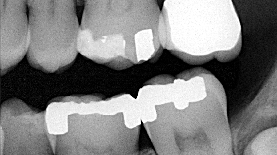 T Carlson Pa Before 63eff6aa5fbb2