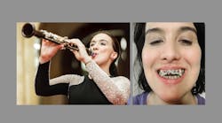 Clarinetist Boja Kragulj says she used the AGGA (Anterior Growth Guidance Appliance) in hopes of correcting her misaligned bite and improving her breathing without surgery. Kragulj has alleged in an ongoing lawsuit that the unproven and unregulated device caused catastrophic harm to her teeth. AGGA inventor Dr. Steve Galella and his company have denied all liability. (Makris Music Society; Boja Kragulj)