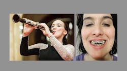 Clarinetist Boja Kragulj says she used the AGGA (Anterior Growth Guidance Appliance) in hopes of correcting her misaligned bite and improving her breathing without surgery. Kragulj has alleged in an ongoing lawsuit that the unproven and unregulated device caused catastrophic harm to her teeth. AGGA inventor Dr. Steve Galella and his company have denied all liability. (Makris Music Society; Boja Kragulj) Clarinetist Boja Kragulj says she used the AGGA (Anterior Growth Guidance Appliance) in hopes of correcting her misaligned bite and improving her breathing without surgery. Kragulj has alleged in an ongoing lawsuit that the unproven and unregulated device caused catastrophic harm to her teeth. AGGA inventor Dr. Steve Galella and his company have denied all liability. (Makris Music Society; Boja Kragulj)