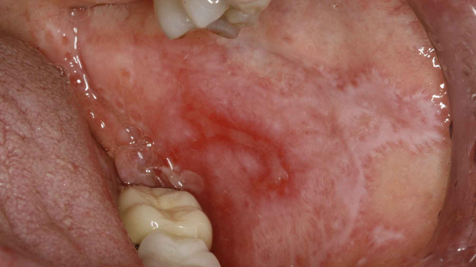 D11 4827 4 jpg 641dfaf178d82