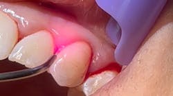 Laser 64246a5be9b60 Laser 64246a5be9b60