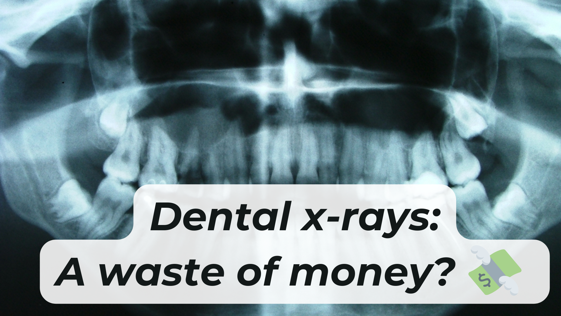 Misconceptions The cost of dental xrays Dentistry IQ