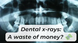 the cost of dental x-rays the cost of dental x-rays