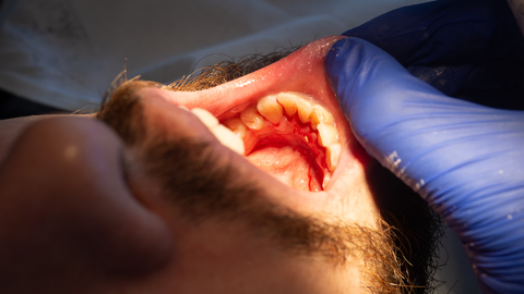 Dreamstime Xs 236745738