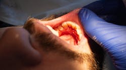 Dreamstime Xs 236745738 Dreamstime Xs 236745738