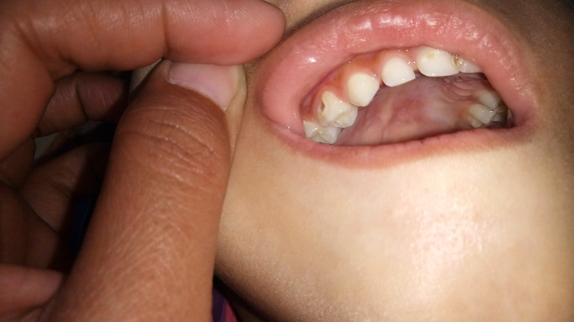 Dreamstime Xxl 154275235 648249861ad4f