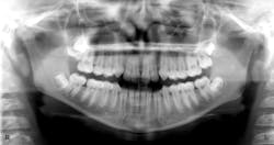 11-year-old male 11-year-old male