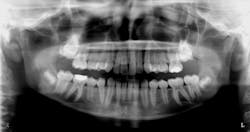 14-year-old male 14-year-old male