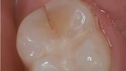 Cracked no. 31 Cracked no. 31