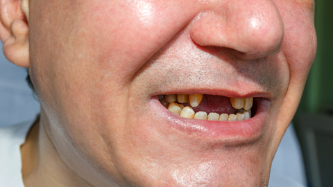 Dreamstime Xs 72368488 64aeee4e14bc0