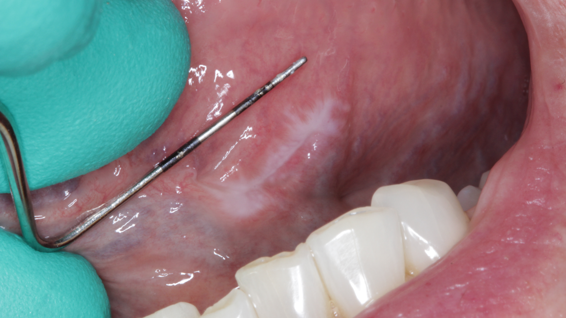 Fig1 8 18 15 3 64b042bfb07ef