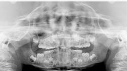 Fig1 Pan 64b054d289530 Fig1 Pan 64b054d289530