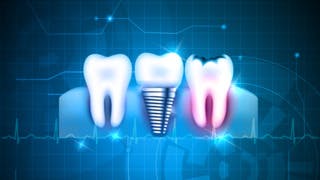 How to embrace digital dentistry in your dental hygiene practice |  Dentistry IQ