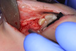 Fig1 Img 2076 Fig1 Img 2076