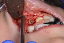 Fig2 Img 2075 Fig2 Img 2075