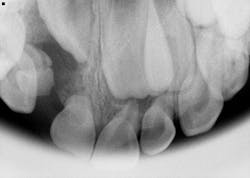 Fig2 Max Anterior 2 Fig2 Max Anterior 2