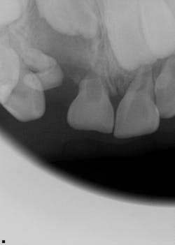 Fig3 Max Anterior Fig3 Max Anterior