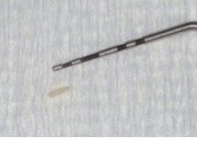 Cotton pliers remove a bone sequestrum measuring 1 mm x 3 mm.