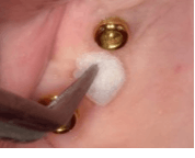 Medicament application Medicament application