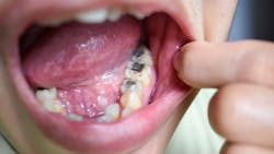 Dreamstime Xs 198088013 64ef7524d0309 Dreamstime Xs 198088013 64ef7524d0309