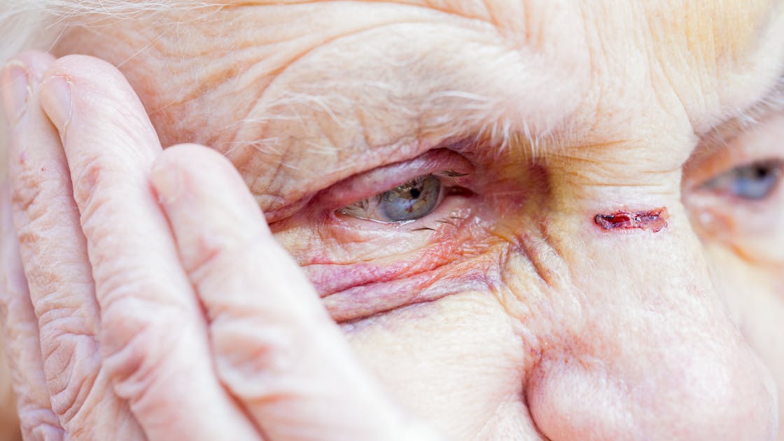 Elder abuse: How to spot warning signs, get help, and report
