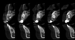 Figure 2: CBCT Figure 2: CBCT