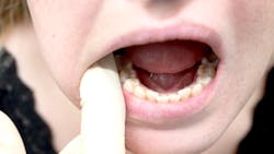 Dental hygienists can identify early signs of life-threatening conditions and pathologies, including oral cancer. Learn what to look during an exam. Dental hygienists can identify early signs of life-threatening conditions and pathologies, including oral cancer. Learn what to look during an exam.