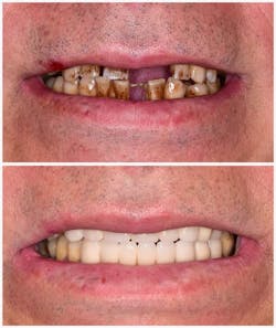 Canva Mae Sl4 E St5 U Canva Mae Sl4 E St5 U