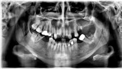 Shumway Patient Shaw 653fdb475d69a Shumway Patient Shaw 653fdb475d69a