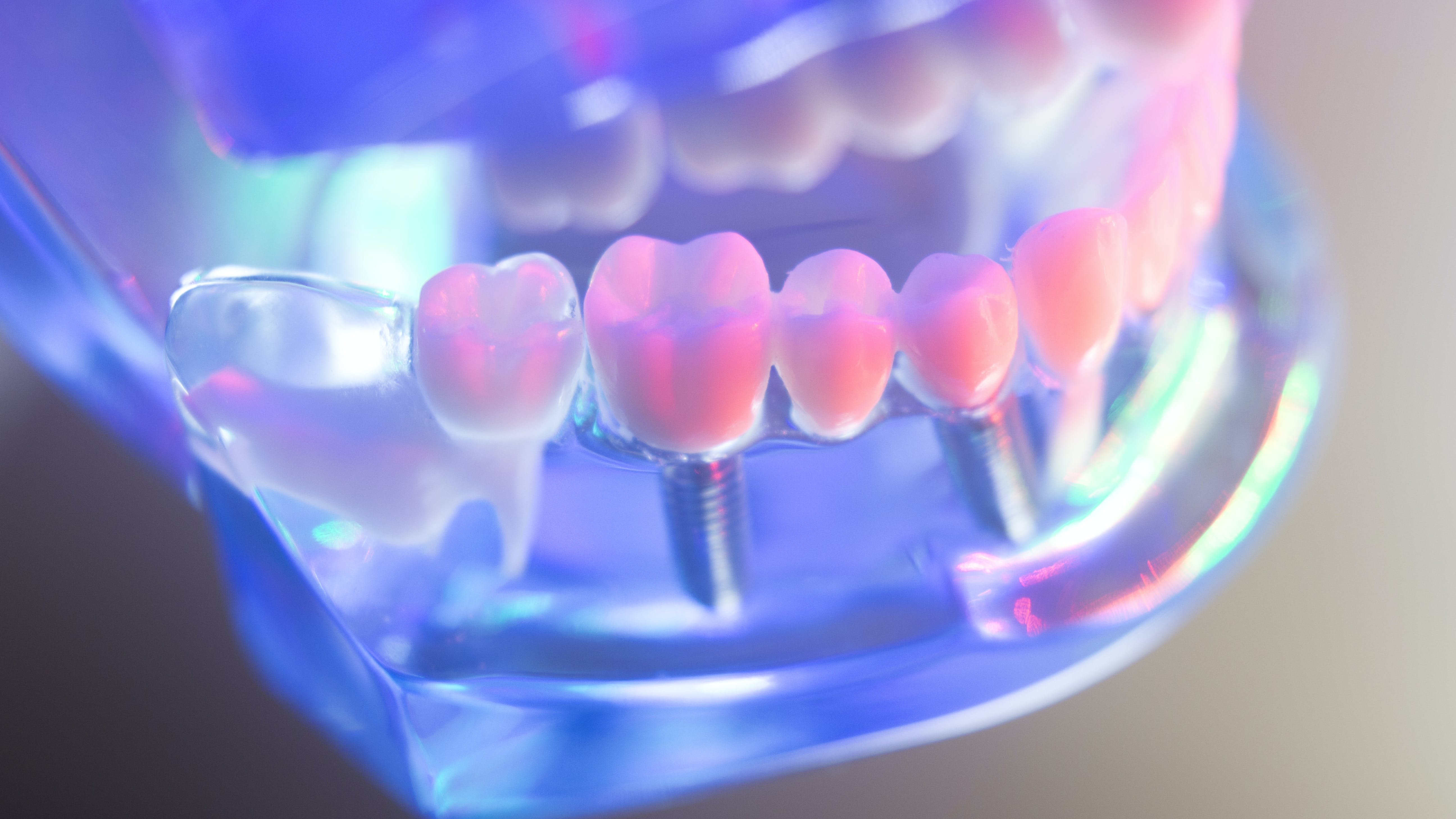 dental-implant-uv-technology