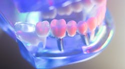 dental-implant-uv-technology dental-implant-uv-technology