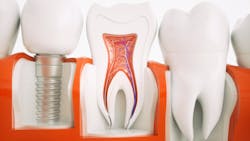 656e36b2ba4767001e2f7aed Dreamstime Xxl 79852895 656e36b2ba4767001e2f7aed Dreamstime Xxl 79852895