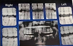 Figure 1: X-rays Figure 1: X-rays