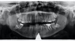 dental-pathology