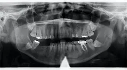 dental-pathology