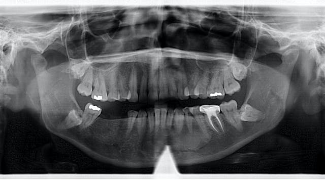 Diagnosis and treatment for Breakthrough Clinical oral pathology case ...