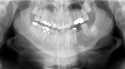dental-pathology